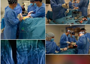 After a 10-year hiatus: Al-Hadba Al-Khadra General Hospital resumes artificial joints operations